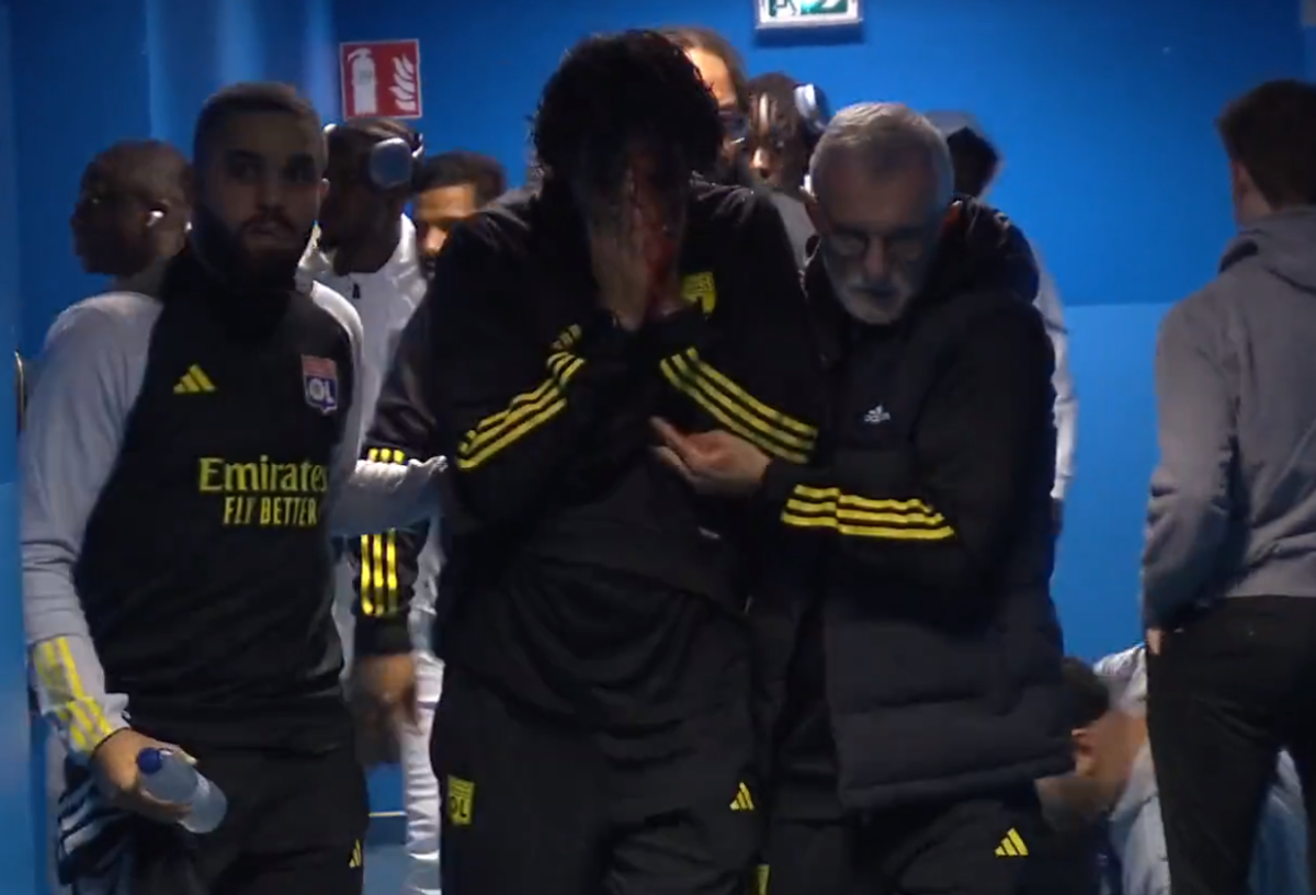 Fabio Grosso, imagini ȘOCANTE din Franța! Antrenorul lui Lyon, plin de sânge după ce autocarul a fost atacat de ultrașii lui Marseille! Meciul poate fi amânat