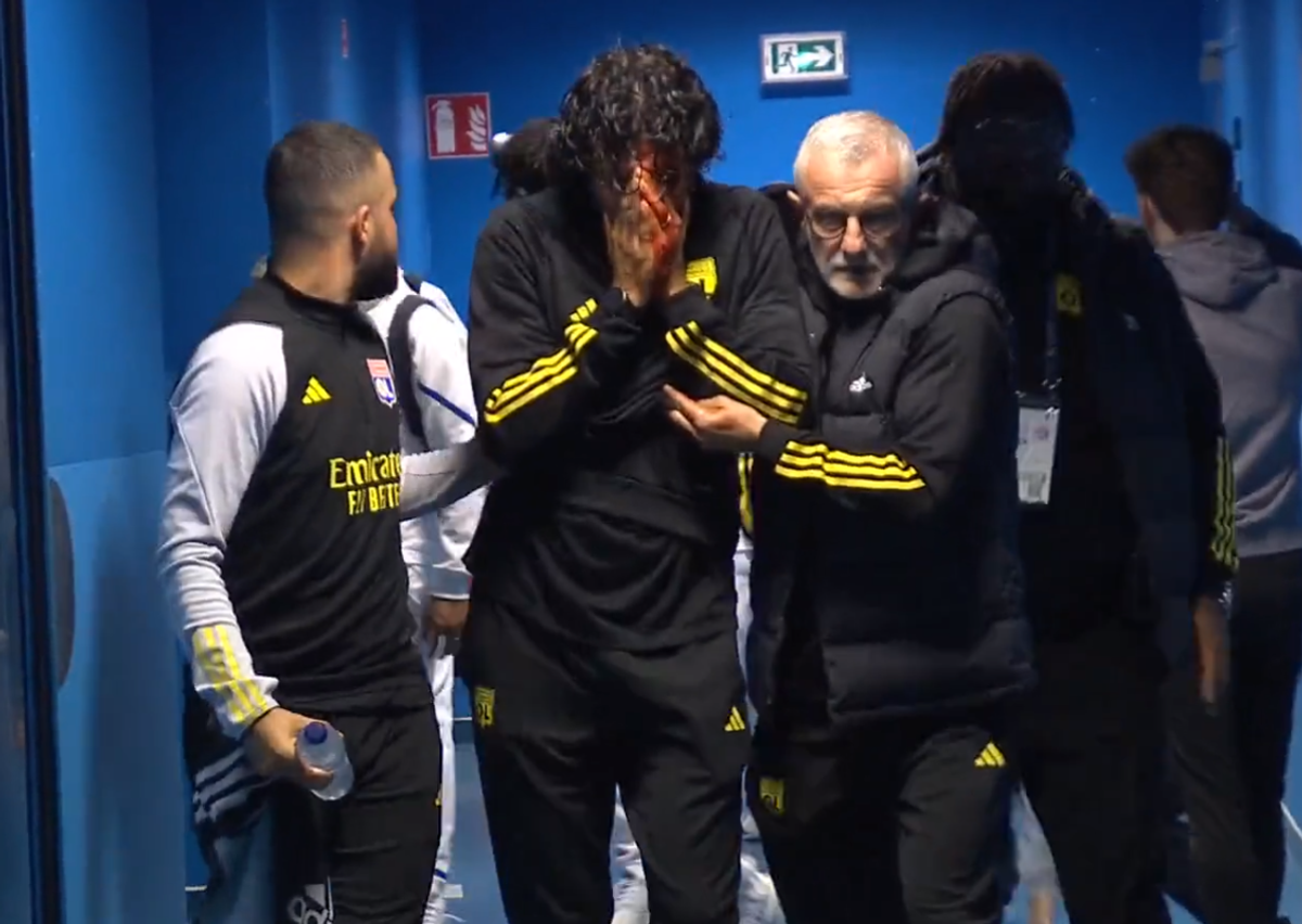 Fabio Grosso, imagini ȘOCANTE din Franța! Antrenorul lui Lyon, plin de sânge după ce autocarul a fost atacat de ultrașii lui Marseille! Meciul poate fi amânat