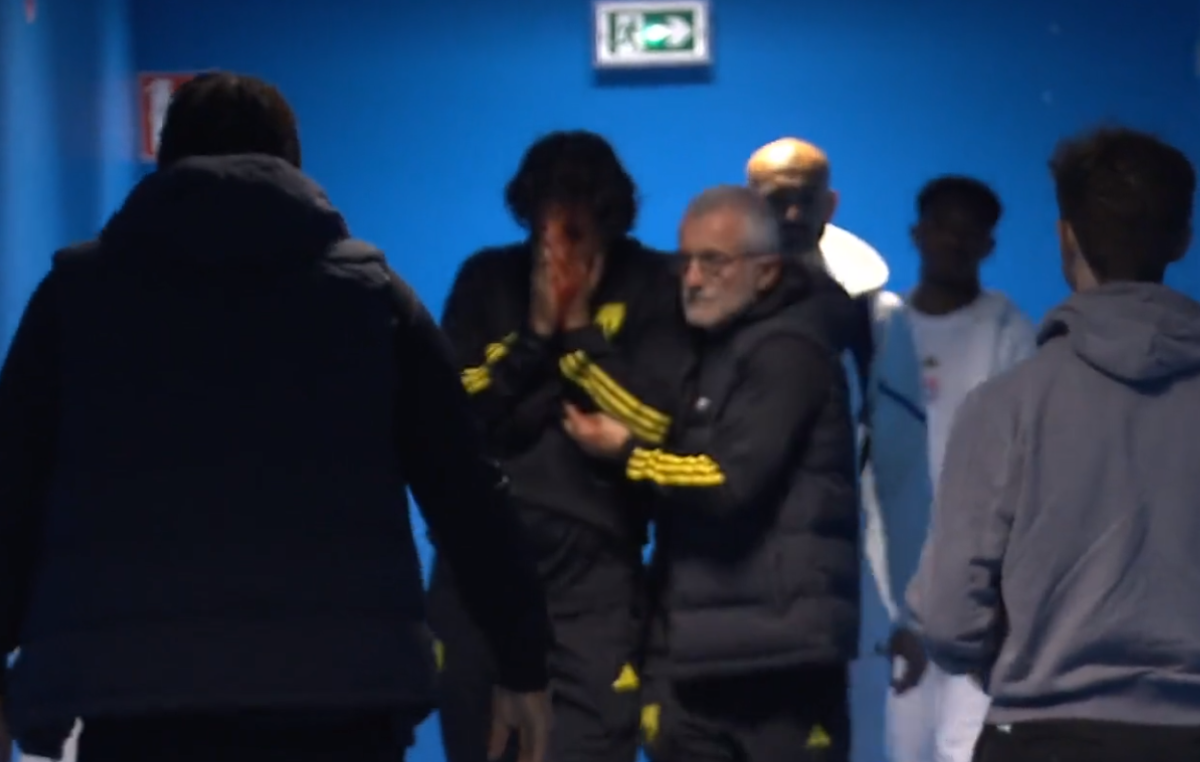 Fabio Grosso, imagini ȘOCANTE din Franța! Antrenorul lui Lyon, plin de sânge după ce autocarul a fost atacat de ultrașii lui Marseille! Meciul poate fi amânat