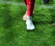 David Miculescu a ajuns la spital după accidentarea din Gloria Bistrița - FCSB, Cupa României. foto: Andrei Furnigă / GSP