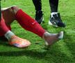 David Miculescu a ajuns la spital după accidentarea din Gloria Bistrița - FCSB, Cupa României. foto: Andrei Furnigă / GSP