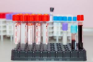 ANAD i-a dat contractul pentru controale antidoping, prin achiziție directă, unei firme abia înființate! Controalele s-au prăbușit: doar 6 în octombrie