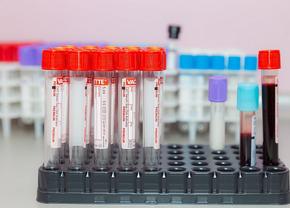 ANAD i-a dat contractul pentru controale antidoping, prin achiziție directă, unei firme abia înființate! Controalele s-au prăbușit: doar 6 în octombrie
