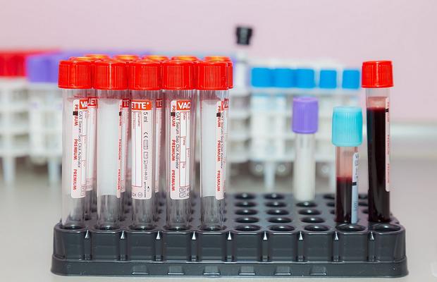 ANAD i-a dat contractul pentru controale antidoping, prin achiziție directă, unei firme abia înființate! » Drept la replică din partea LaboraNova Medical