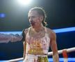 Gabriela Timar a încheiat lupta plină de sânge // foto: Imago Images