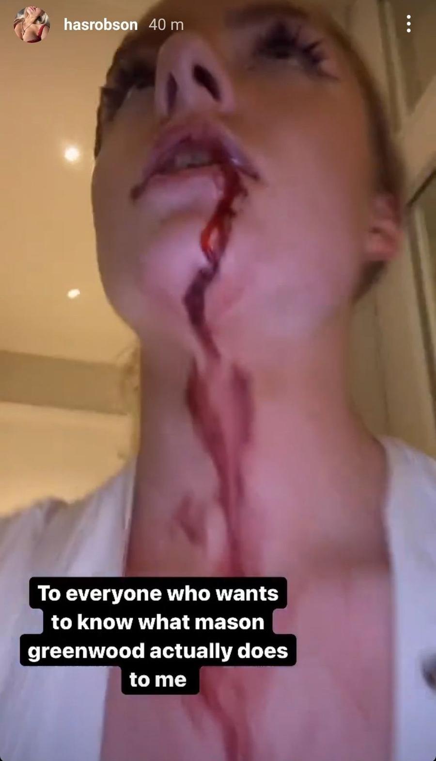 Greenwood, adus la audieri și suspendat de Manchester United! E acuzat de violență și viol