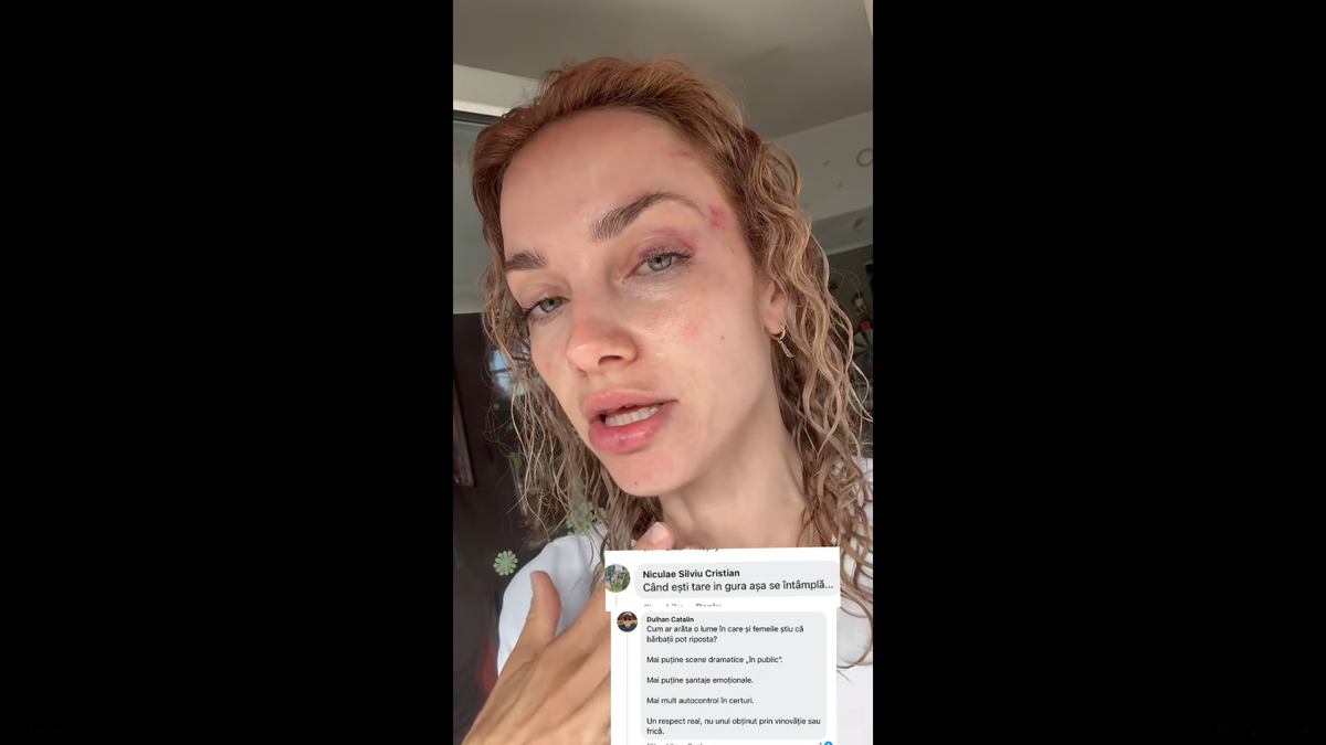 O femeie a fost bătută în Cluj de un suporter al Universității