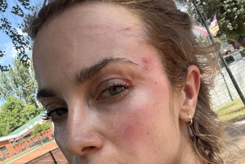 Scene reprobabile într-un parc din Cluj! O femeie a fost agresată de un bărbat, fan Universitatea Cluj. FOTO: Facebook @Siuko Siu