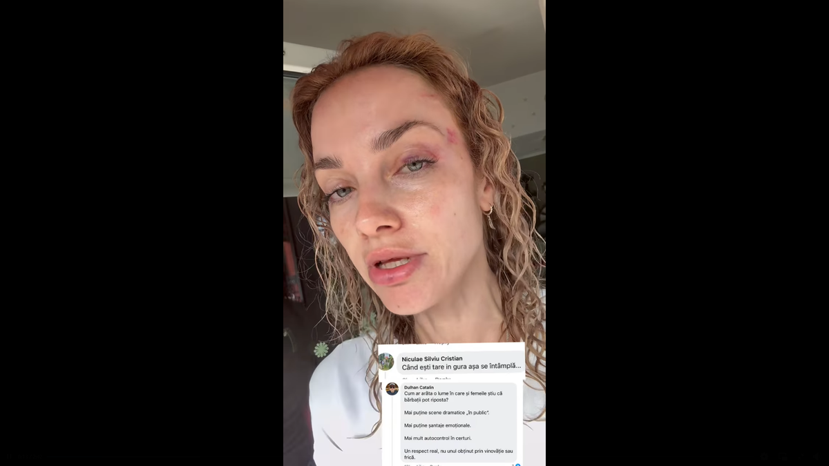 Scene șocante la Cluj! O femeie a fost bătută de un fan U Cluj în parc: „A presupus că sunt ucraineancă și că nu am niciun drept aici” / Dreptul la replică al bărbatului