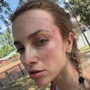 O femeie a fost bătută în Cluj de un suporter al Universității. FOTO: Facebook @Siuko Siu