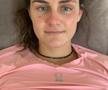 Vindecare în timp record » Cum arată acum Alice Merryweather, schioarea accidentată grav în urmă cu 3 săptămâni. Atenție, imagini dure!