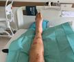 Vindecare în timp record » Cum arată acum Alice Merryweather, schioarea accidentată grav în urmă cu 3 săptămâni. Atenție, imagini dure!