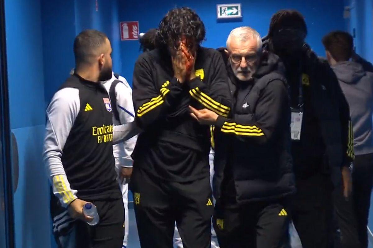 Cum arată fața lui Fabio Grosso, a doua zi după ce a fost atacat cu pietre de ultrașii lui Marseille