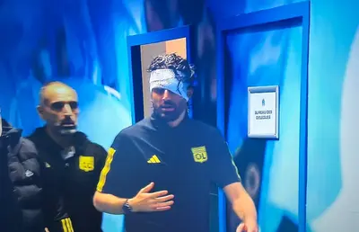 Comoție și 10 puncte de sutură pentru Fabio Grosso! Ministrul Sportului francez atacă dur: „E deprimant și dezgustător”