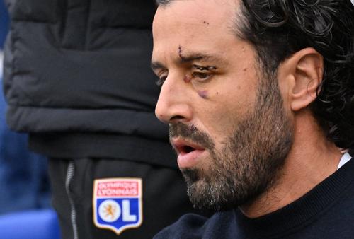 Fabio Grosso, fostul antrenor al lui Olympique Lyon, cu cicatricea rămasă după atacul ultrașilor lui Marseille Foto: Imago