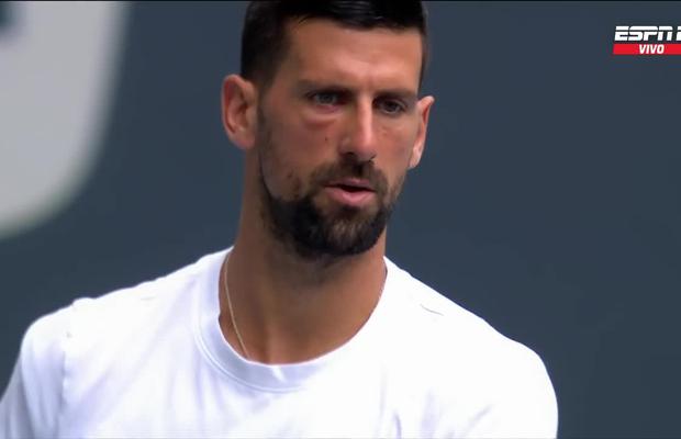 Care este motivul pentru care Novak Djokovic a apărut cu ochiul umflat și vânăt la Miami Open
