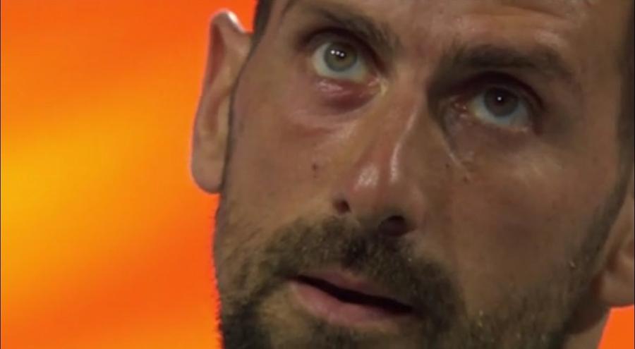 Care este motivul pentru care Novak Djokovic a apărut cu ochiul umflat și vânăt la Miami Open
