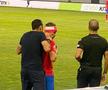 Darius Olaru, cu arcada spartă în Maccabi Tel Aviv- FCSB // foto: GSP