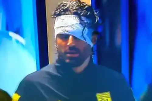 Fabio Grosso (45 de ani), antrenorul lui Lyon, a oferit un mesaj după ce a fost lovit grav înaintea meciului cu Marseille, amânat în urma celor întâmplate.