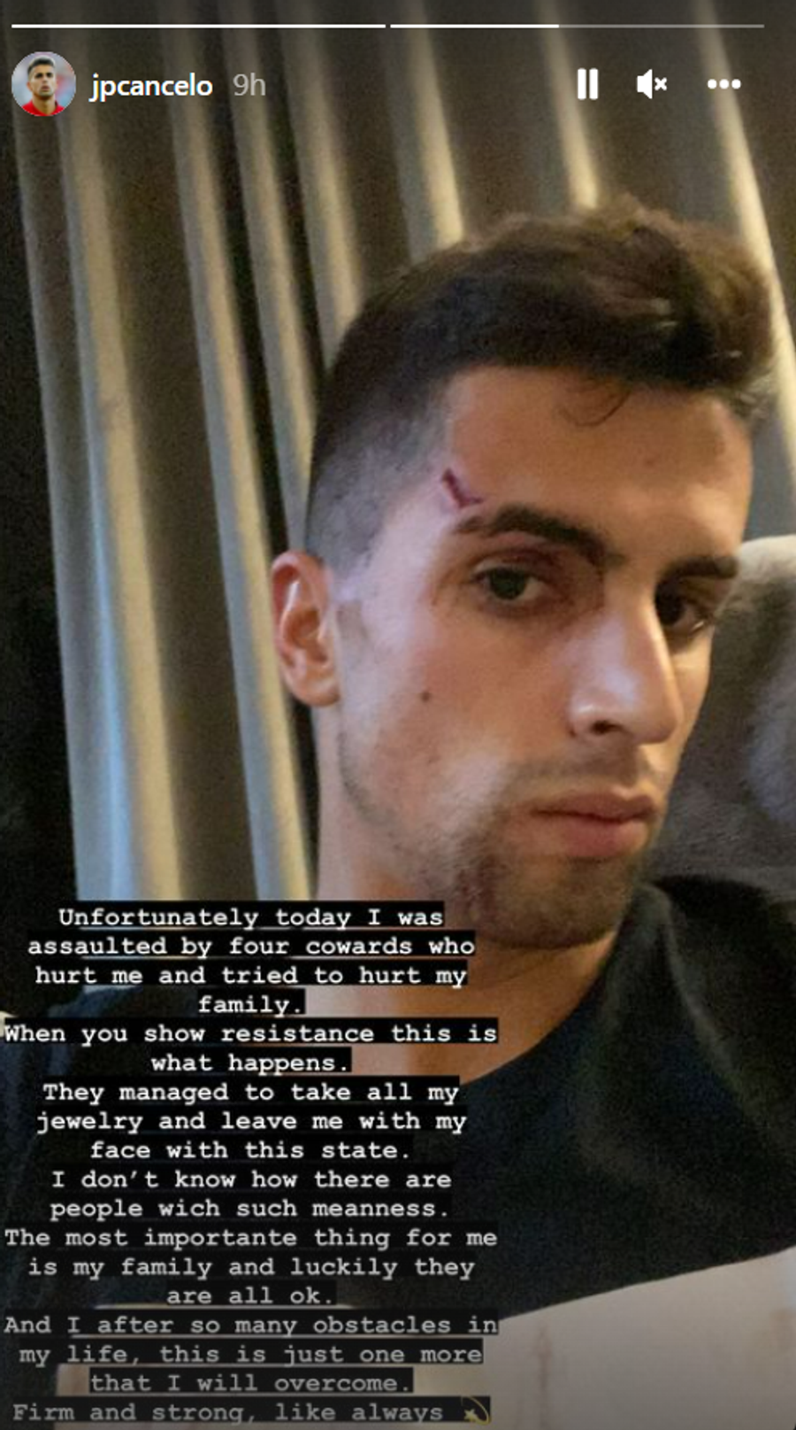 Un star de la City, atacat de hoți: „Mi-au luat toate bijuteriile, uitați cum arată fața mea!”