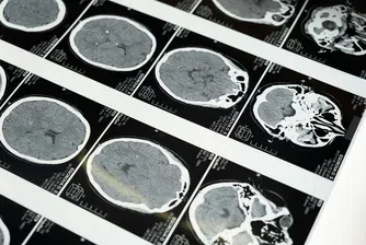 Извън границите на съзнанието: Нова технология може да прочете мислите ни