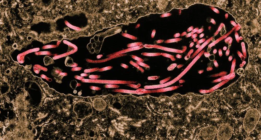 СЗО: Епидемията от Ебола вече е международна здравна опасност