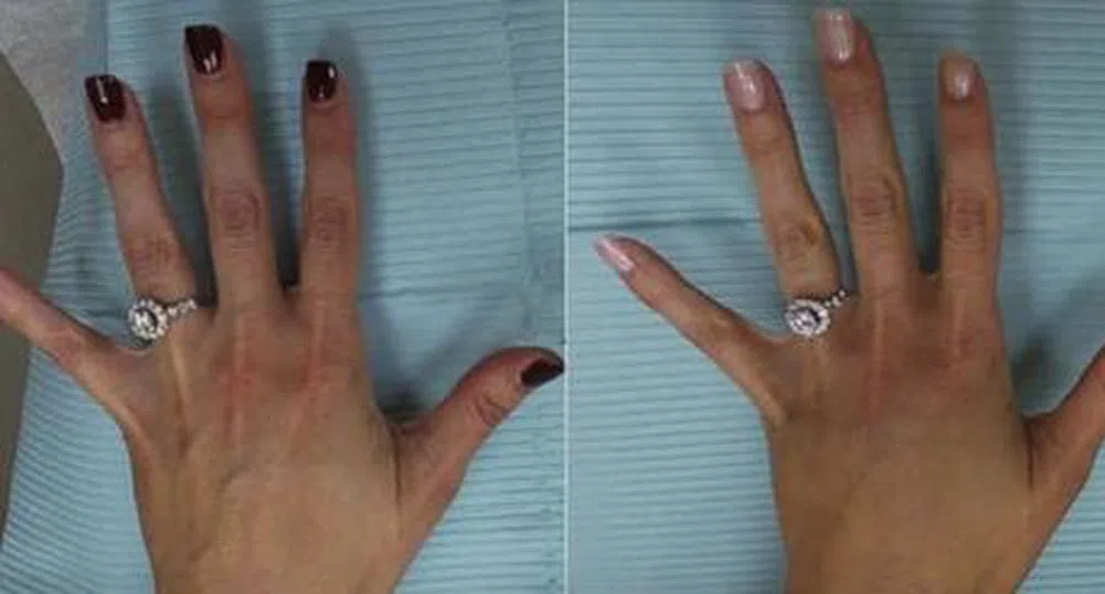 Жена оперира ръцете си, за да изглеждат по-добре на селфита