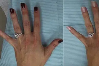 Жена оперира ръцете си, за да изглеждат по-добре на селфита