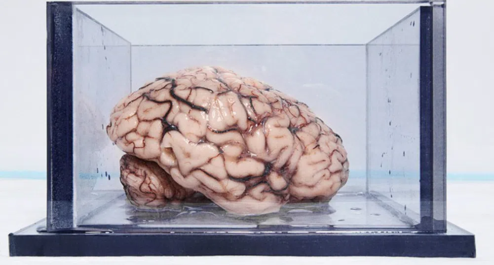 Най-известният мозък в света