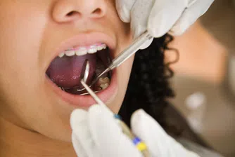 12 неща, които зъболекарят ще разбере, само като отвори устата ви