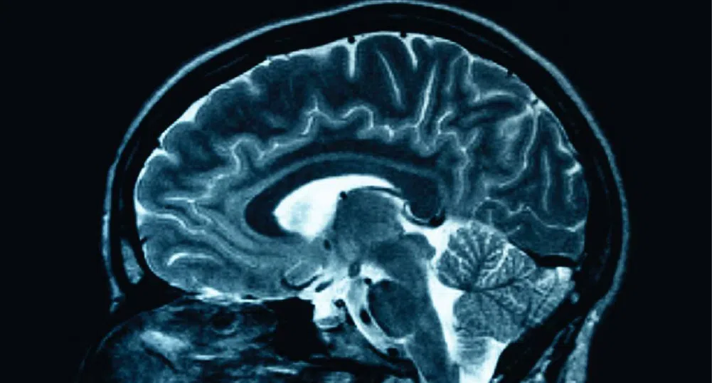 Учени: Човешкият мозък е достигнал своя предел