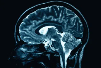 Учени: Човешкият мозък е достигнал своя предел