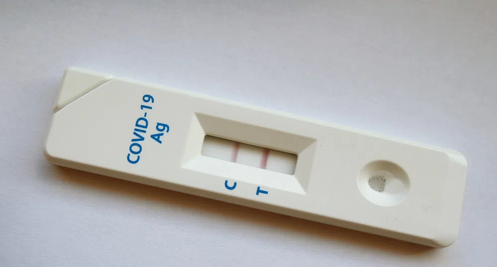 Делът на положителните проби за COVID-19 пада до 17 на сто