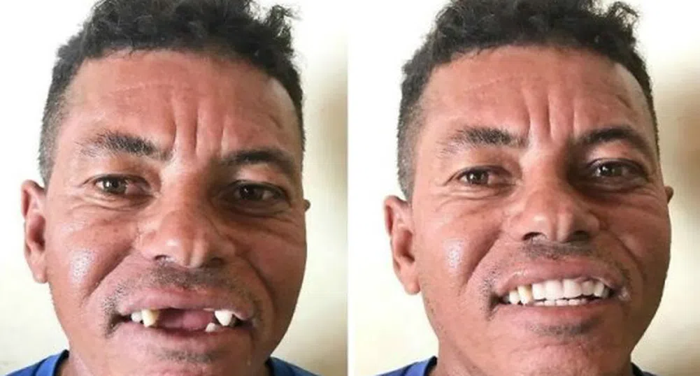 Как един зъболекар в Бразилия помага на бедните?