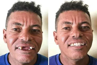Как един зъболекар в Бразилия помага на бедните?