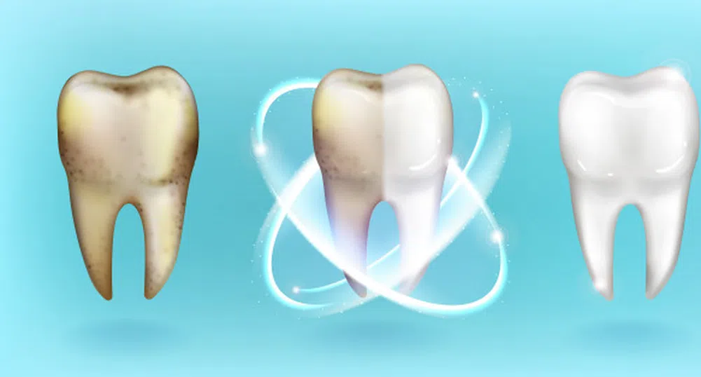 Странни факти за зъбите, които всъщност са верни