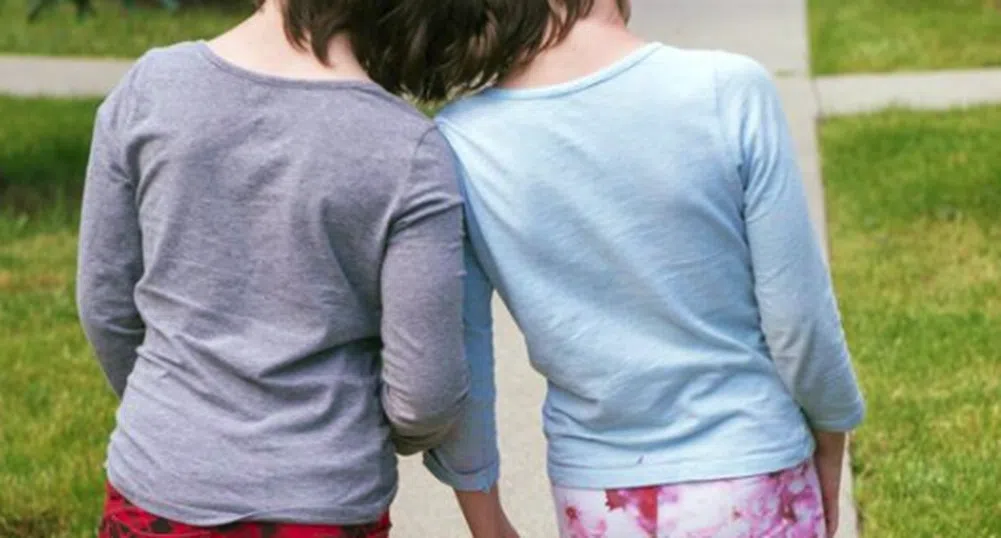 Близначки с общ мозък и череп: те са на 10 г, а не им дават и ден
