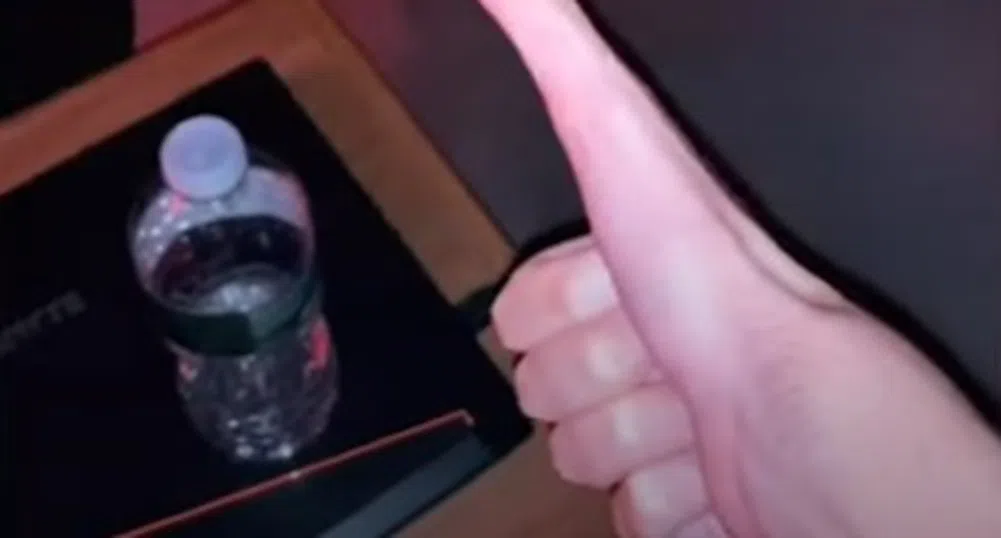 Неговият необичайно дълъг палец го направи звезда в TikTok (видео)