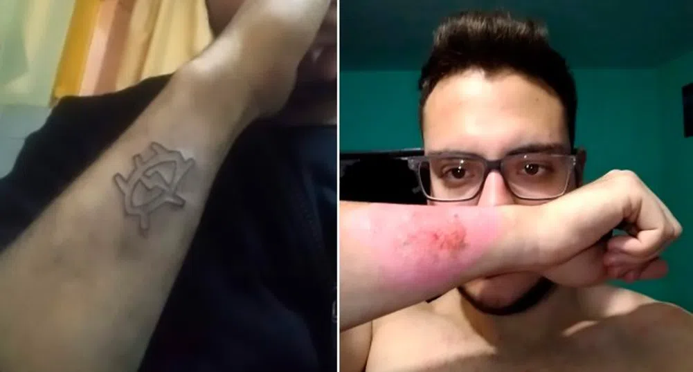 Мъж премахна татуировка с ренде (снимки)