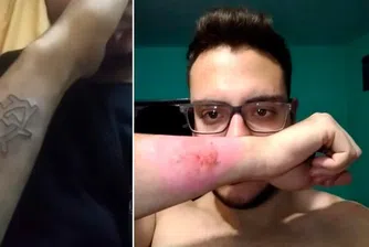Мъж премахна татуировка с ренде (снимки)
