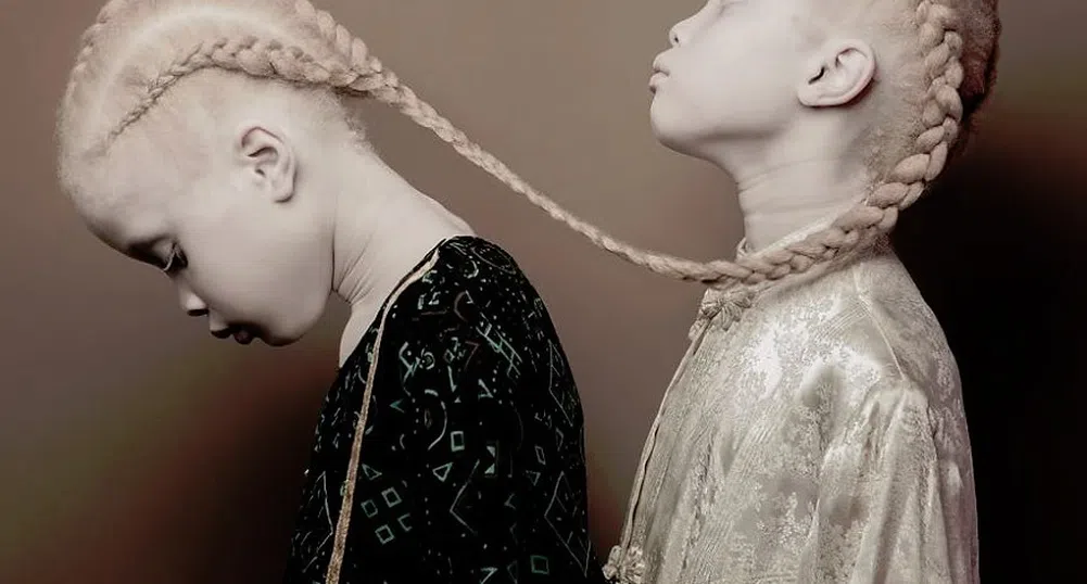 Близначките албиноси, които поразиха модния свят