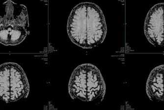 Учени идентифицират пет „епохи“ в развитието на човешкия мозък