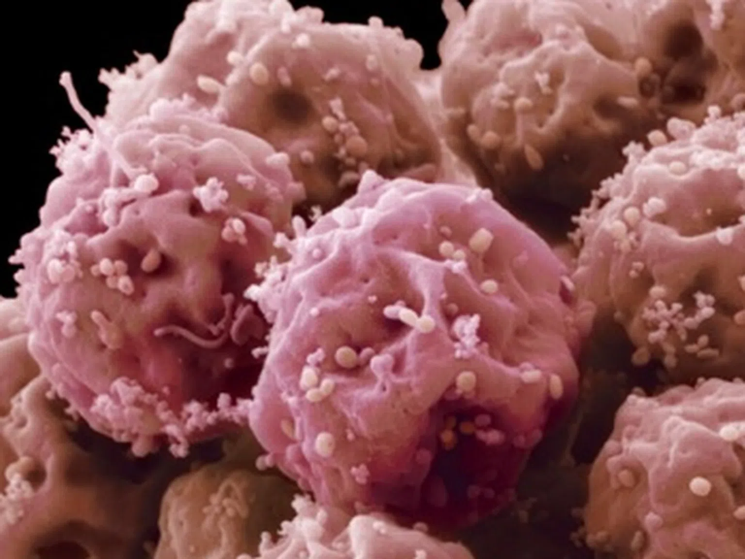 Стволовите клетки - какво трябва да знаете за тях?