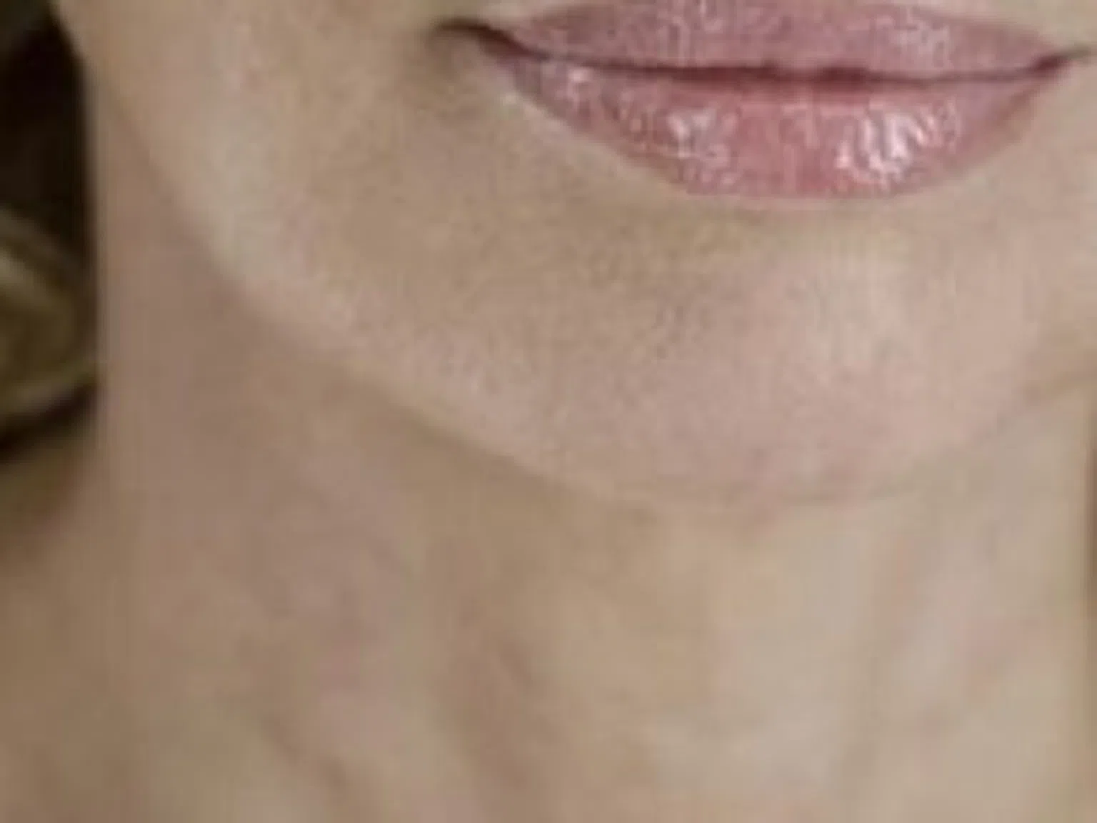 Защо корекциите на устните са една от най-честите интервенции?