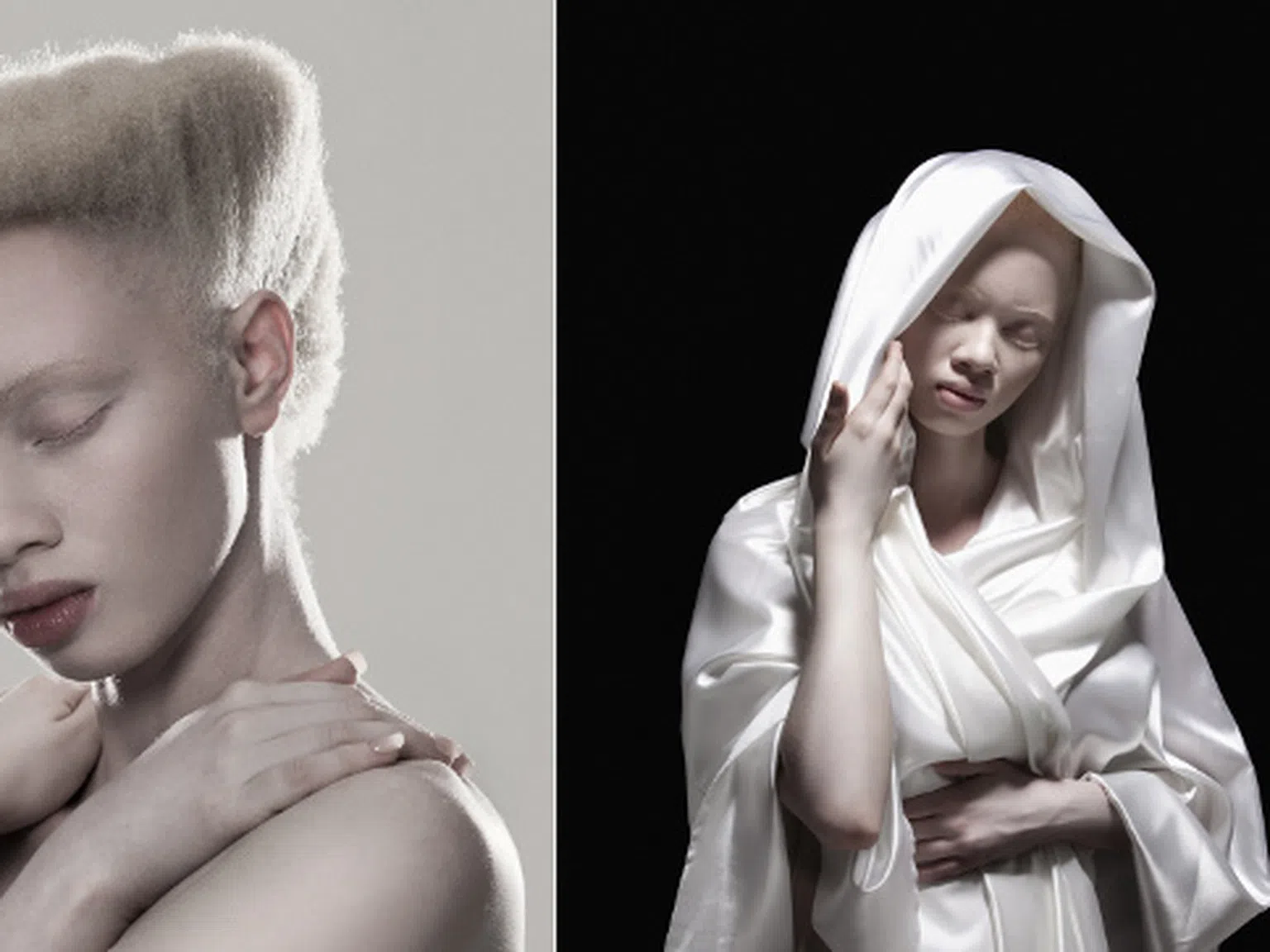 Знаете ли всъщност нещо за албинизма?