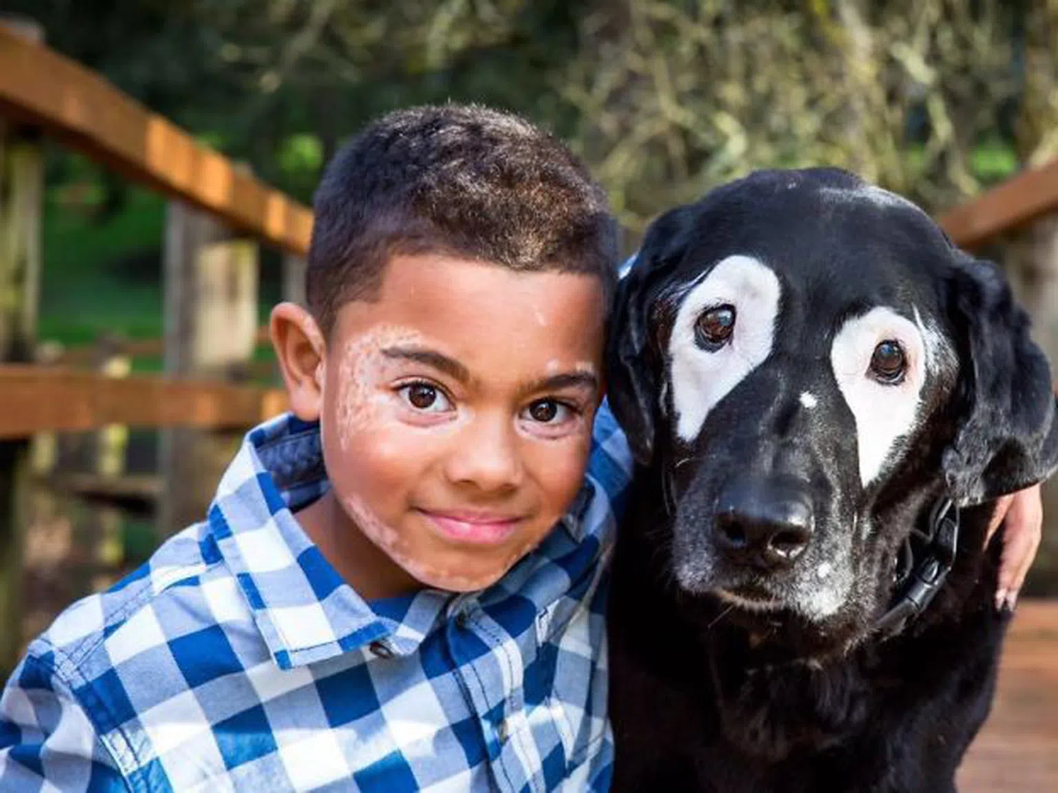 Дете с рядко заболяване срещна своето куче близнак