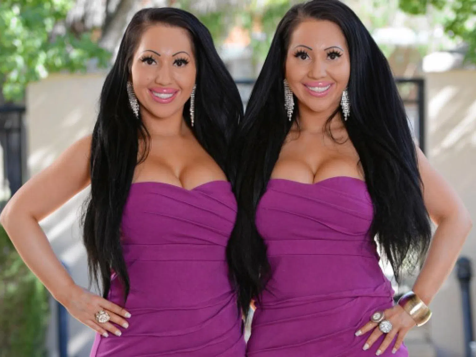 Близначки дадоха 200 000 долара, за да приличат една на друга