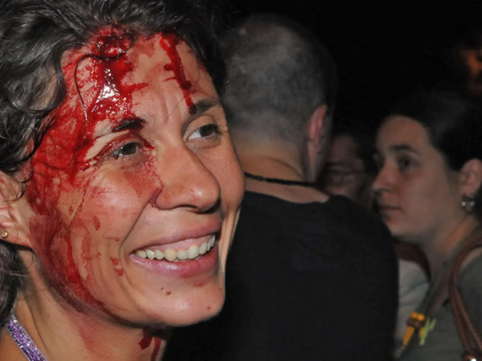 Окървавената жена от протеста: Орешарски, love, GIVE IT UP!