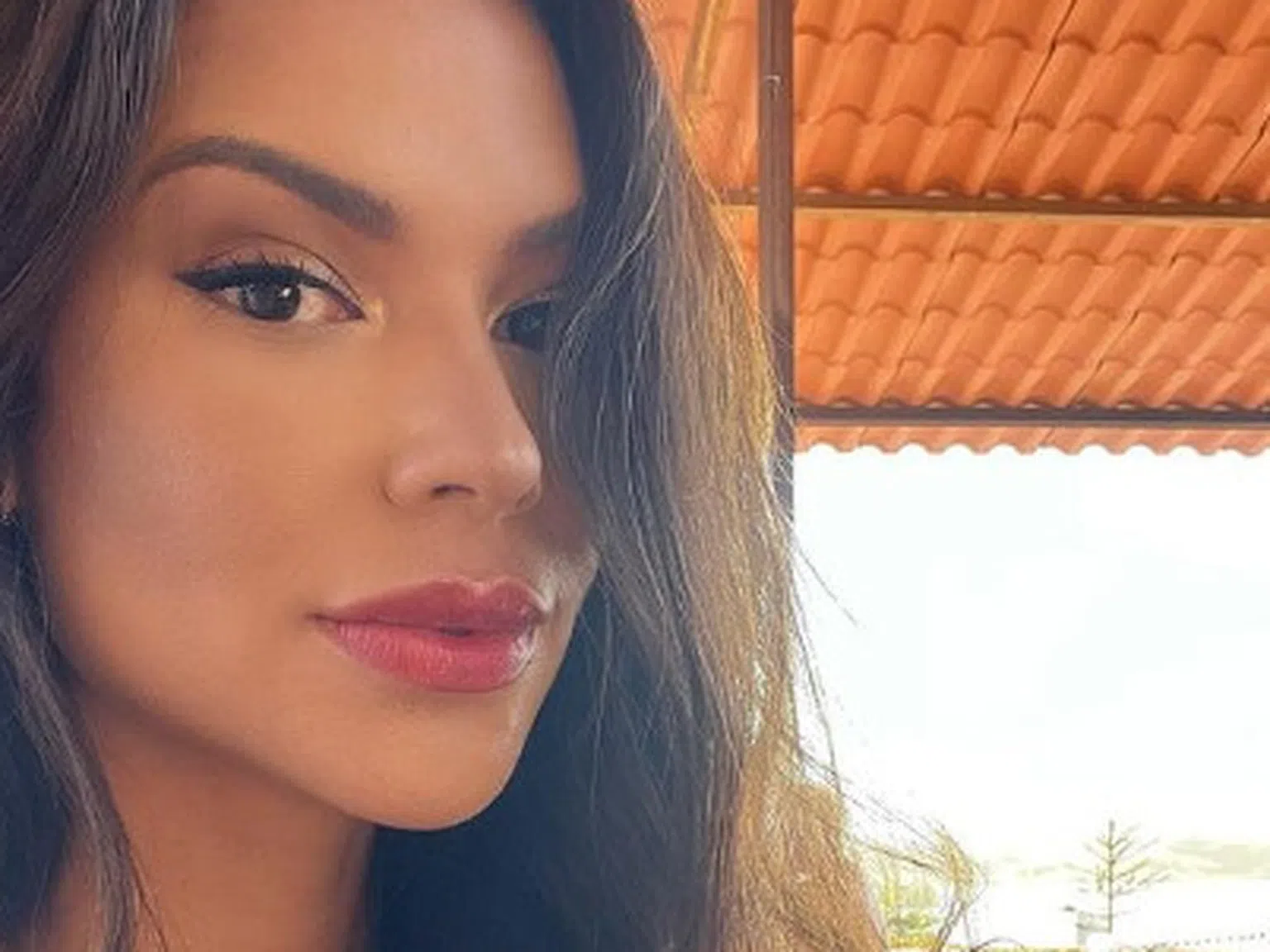 Мис Бразилия почина след операция на сливиците