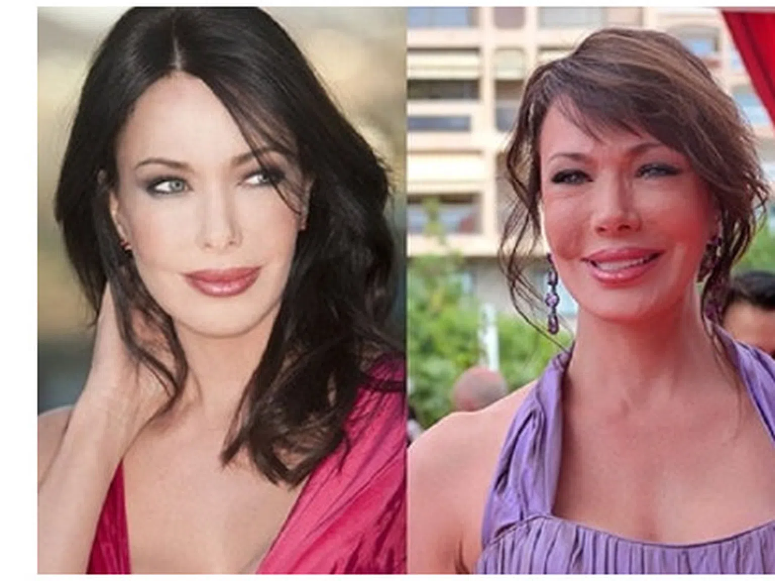 Актьорите от "Дързост и красота" - преди и сега